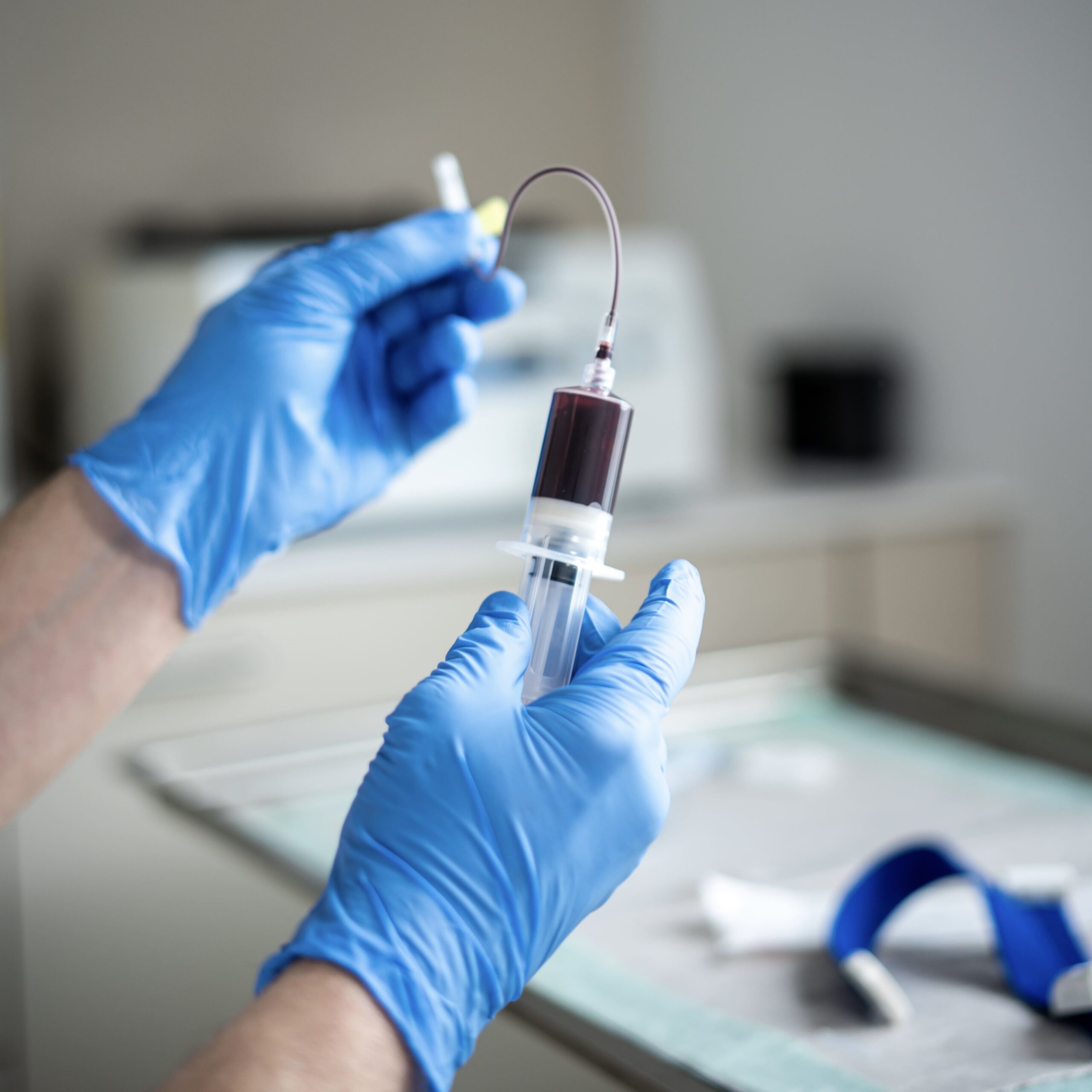 PRP-Therapie: aufbereitetes Eigenblut in der Spritze