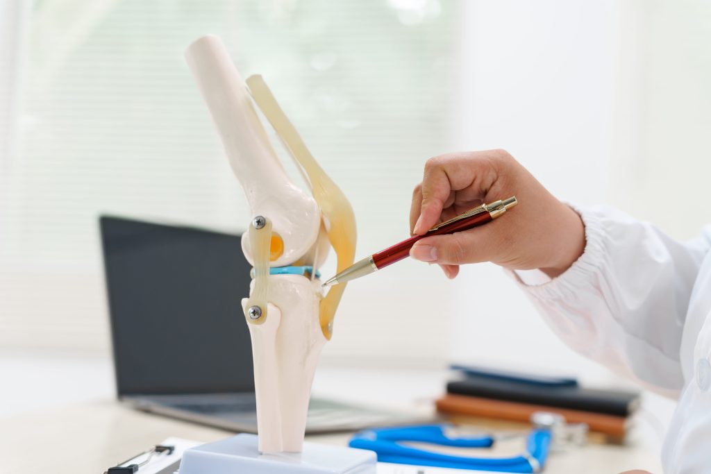 Meniskusriss Hinterhorn: Therapie, Übungen und biologische Behandlung